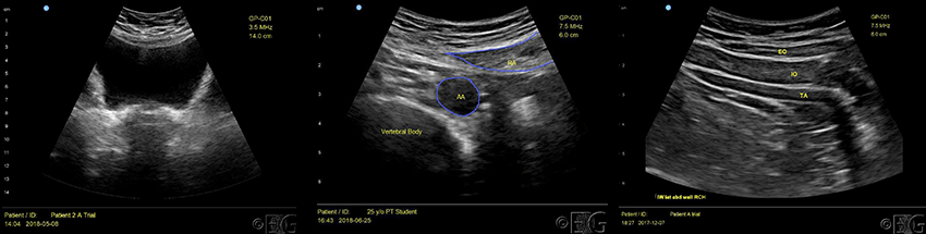 PWC Eugene - ultrasound rehabilitation